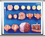 HUMAN FERTILIZATION AND EMBRYOGENY MODEL (IMPORTED)